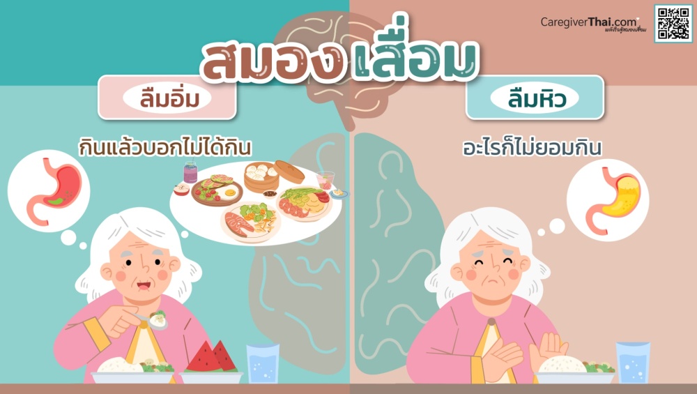 สมองเสื่อม ลืมอิ่ม-ลืมหิว